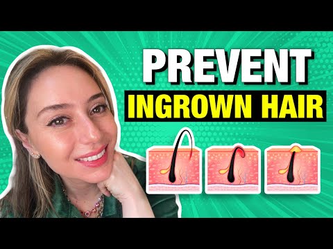 4 Tips & Tricks to Prevent Ingrown Hair! | Dr. Shereene Idriss