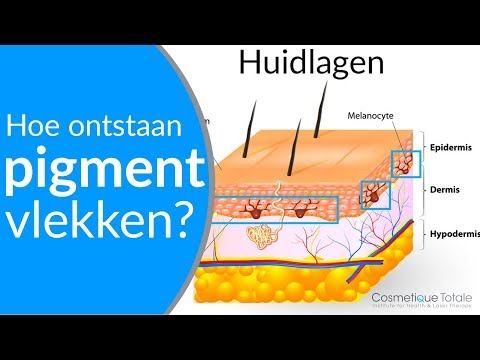 PIGMENTVLEKKEN - Hoe ontstaan pigmentvlekken - (Wat zijn pigmentvlekken)