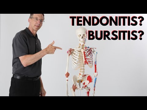 What is Causing Your Shoulder Pain? Tendonitis? Bursitis? How to Know?